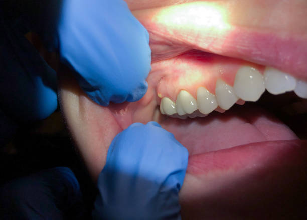 Best Emergency Cosmetic Dentistry (e.g., broken veneers) in Doa Ana, NM